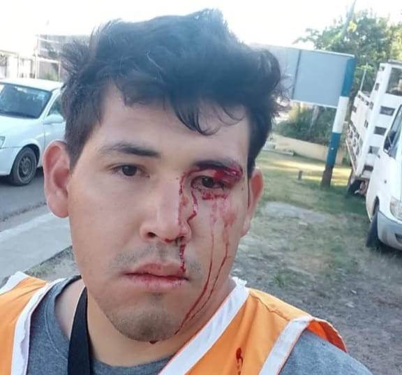 Indignante: denuncian que golpearon en patota a un joven con autismo