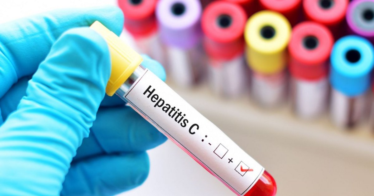 La OMS advierte que 8 de cada 10 personas no accede al tratamiento contra la Hepatitis C