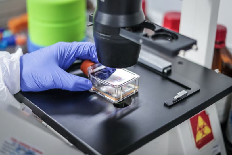 Cuáles son los síntomas de la variante "Frankenstein" del Covid detectada en Argentina