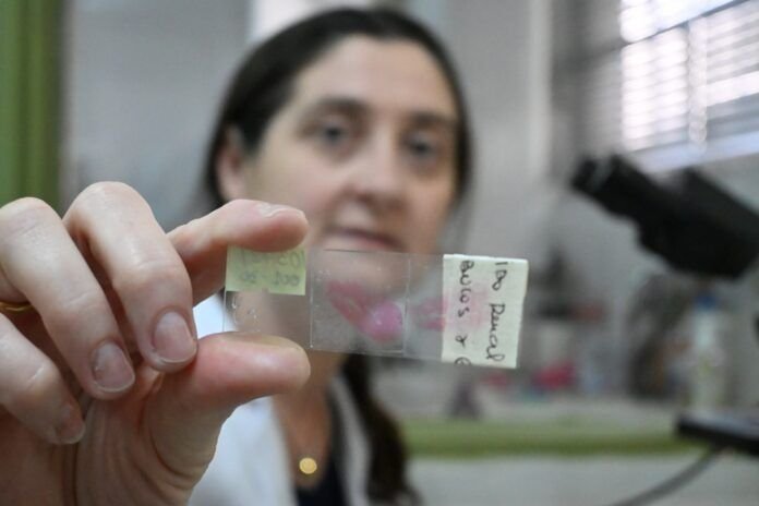 Científicos de Corrientes hallaron una proteína que podría ayudar a tratar el cáncer renal
